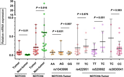 Prognostic value of Notch receptors in postsurgical patients with hepatitis B virus-related hepatocellular carcinoma