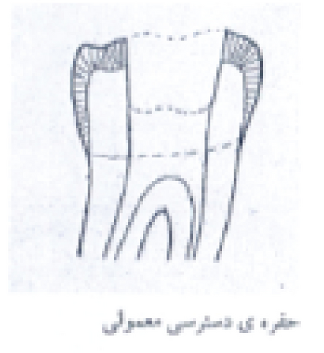 Details are in the caption following the image