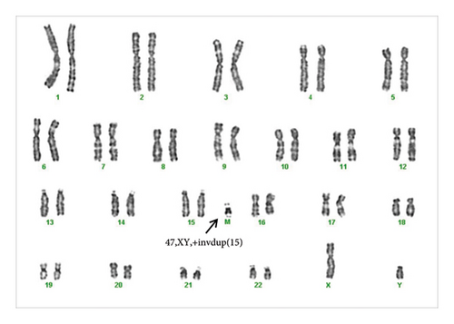 Details are in the caption following the image Details are in the caption following the image