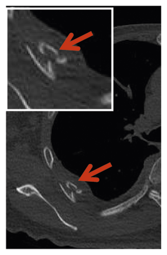 Details are in the caption following the image