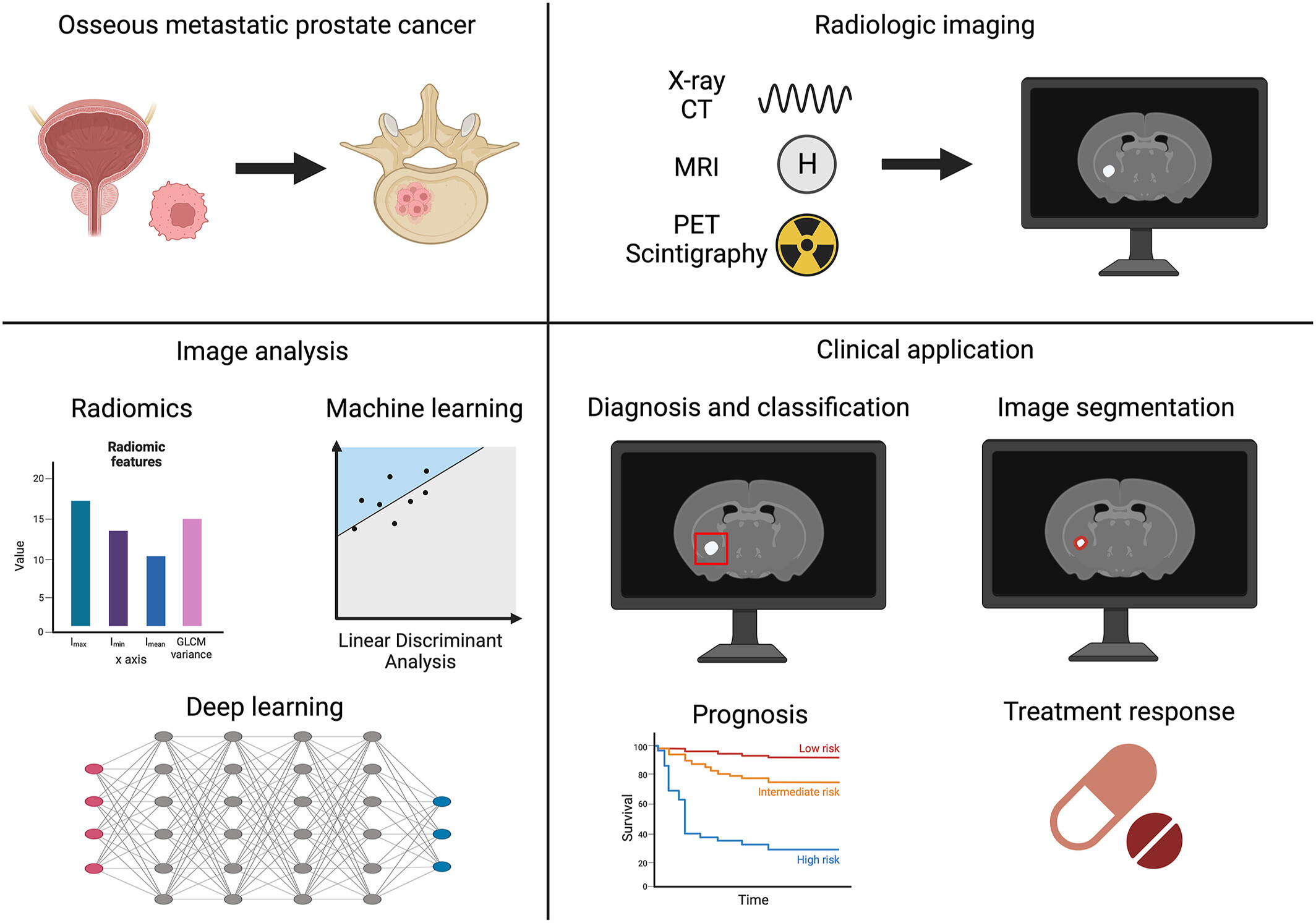 Artificial intelligence and radiomics applied to prostate cancer bone metastasis imaging: A review