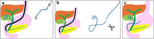 Details are in the caption following the image Details are in the caption following the image