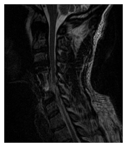 Details are in the caption following the image