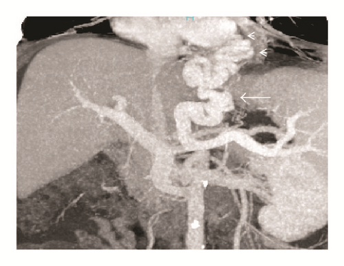 Details are in the caption following the image