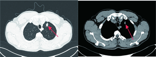 Details are in the caption following the image Details are in the caption following the image
