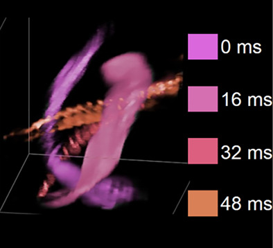 Single-shot optical projection tomography for high-speed volumetric imaging of dynamic biological samples