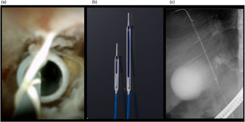 Details are in the caption following the image Details are in the caption following the image