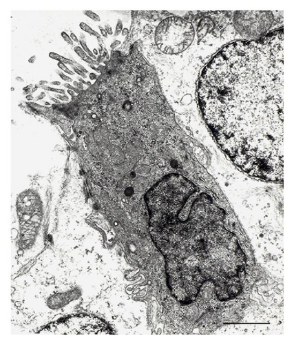 Details are in the caption following the image