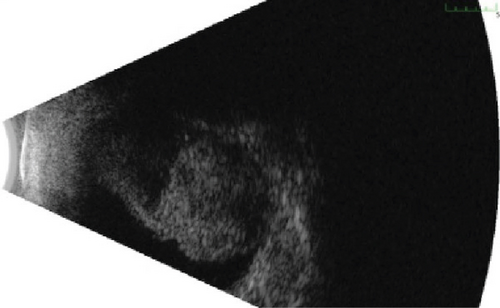 Details are in the caption following the image