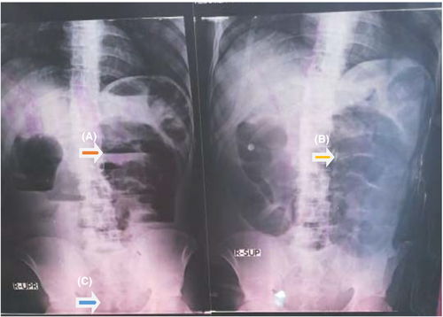 Details are in the caption following the image Details are in the caption following the image