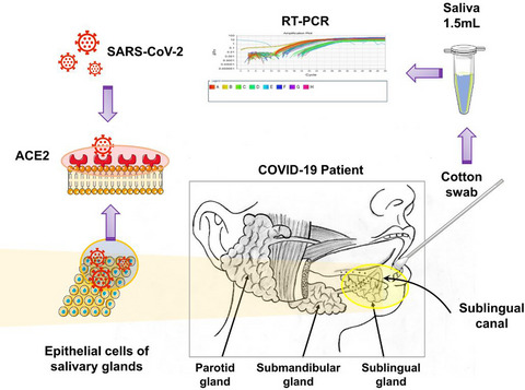 Detection of SARS-CoV-2 in saliva and characterization of oral symptoms in COVID-19 patients