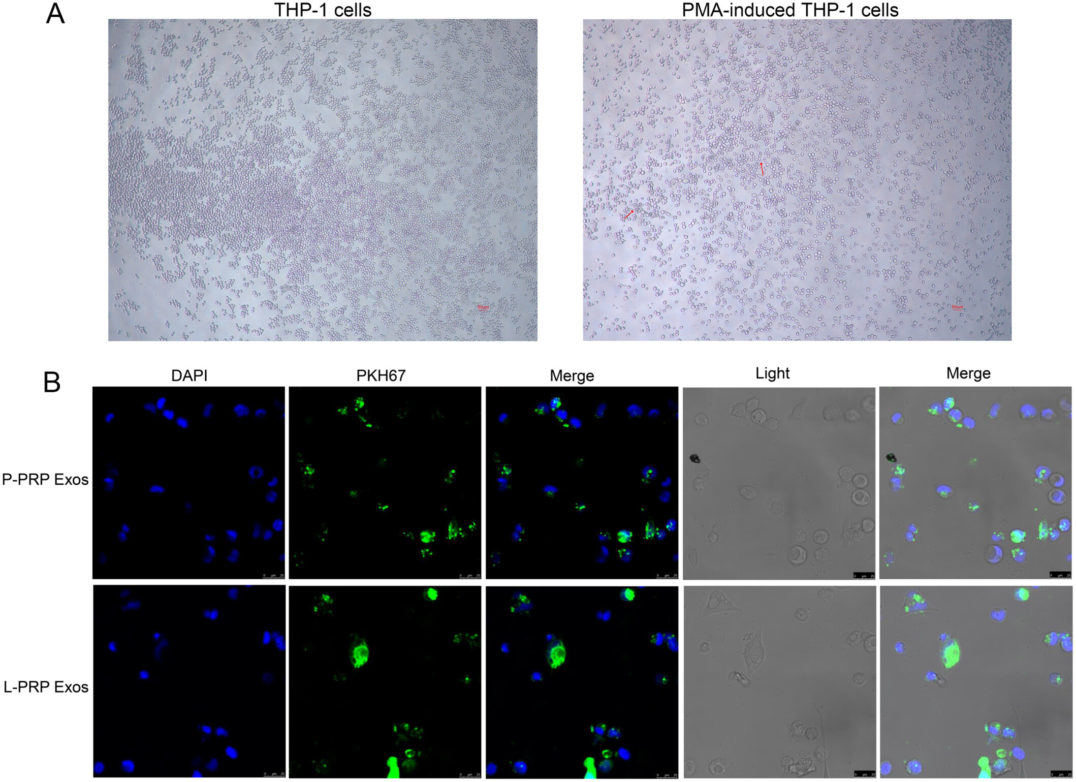 Leukocyte Platelet-Rich Plasma-Derived Exosomes Restrained Macrophages Viability and Induced Apoptosis, NO Generation, and M1 Polarization