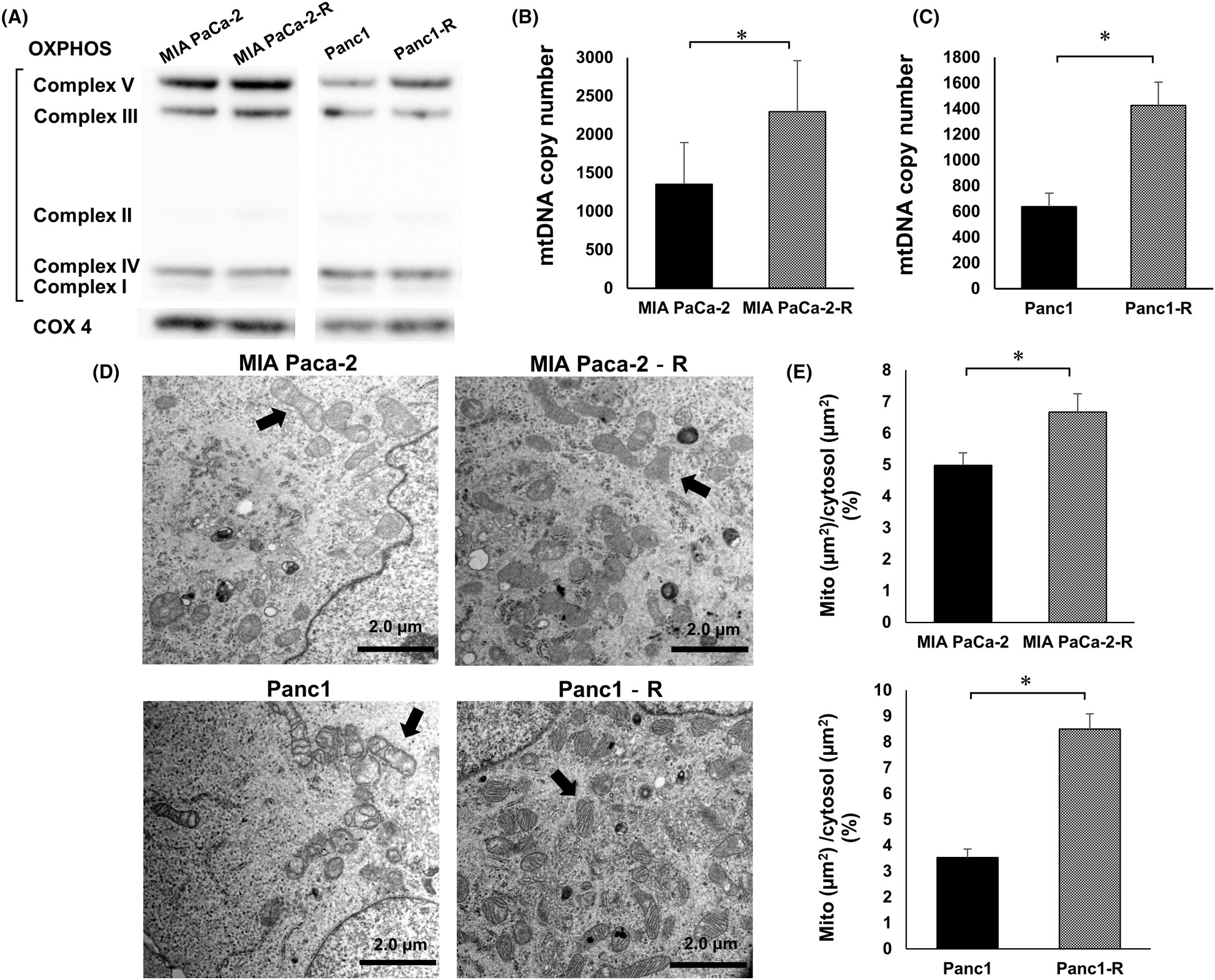 Increased mitochondria are responsible for the acquisition of gemcitabine resistance in pancreatic cancer cell lines