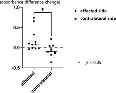 Improvement of vertigo symptoms and acoustic power absorbance in cases with endolymphatic hydrops