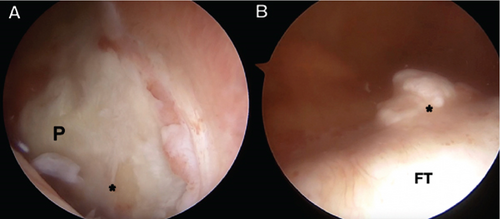 Details are in the caption following the image Details are in the caption following the image