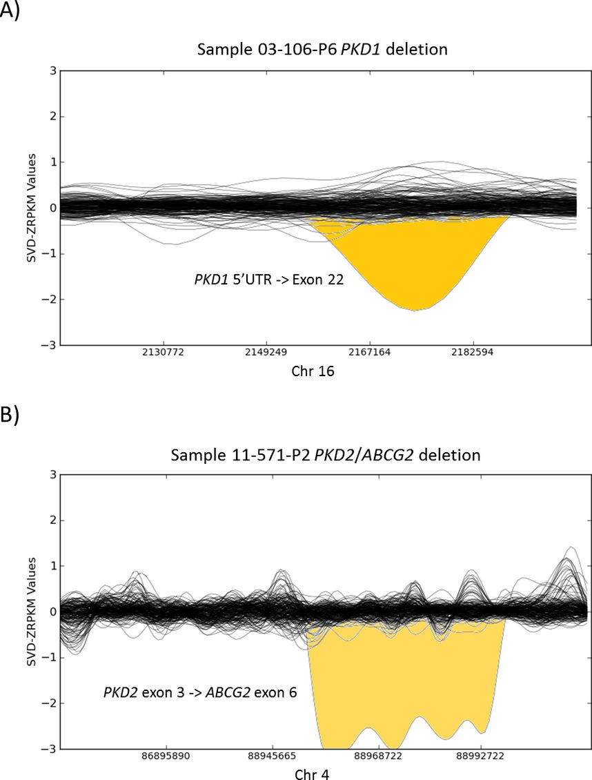 Diagnosis of autosomal dominant polycystic kidney disease using efficient PKD1 and PKD2 targeted next-generation sequencing