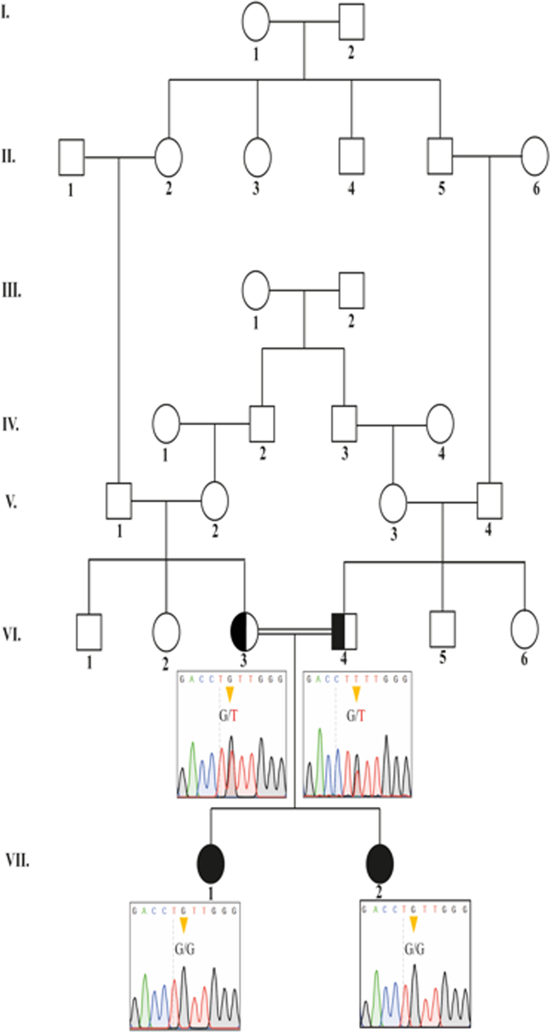 Pontocerebellar Hypoplasia and Periventricular Leukomalacia Associated With p.Phe262Val Homozygous Variant in TTC1 Gene: A Report of 4 Cases