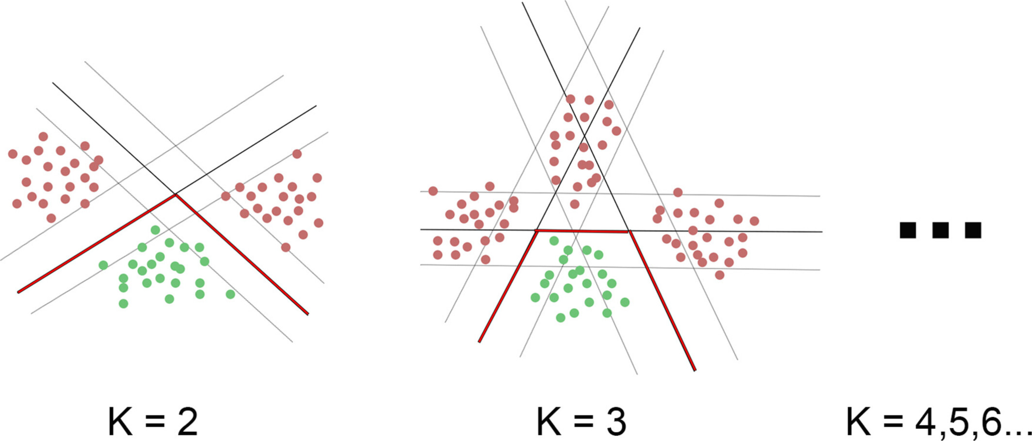 Analysis of Two Neuroanatomical Subtypes of Parkinson's Disease and Their Motor Progression Based on Semi-Supervised Machine Learning