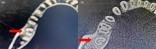 Details are in the caption following the image