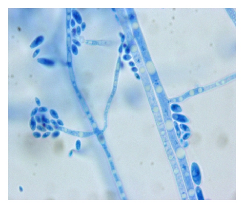Details are in the caption following the image