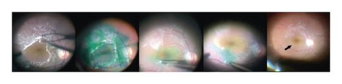 Details are in the caption following the image Details are in the caption following the image