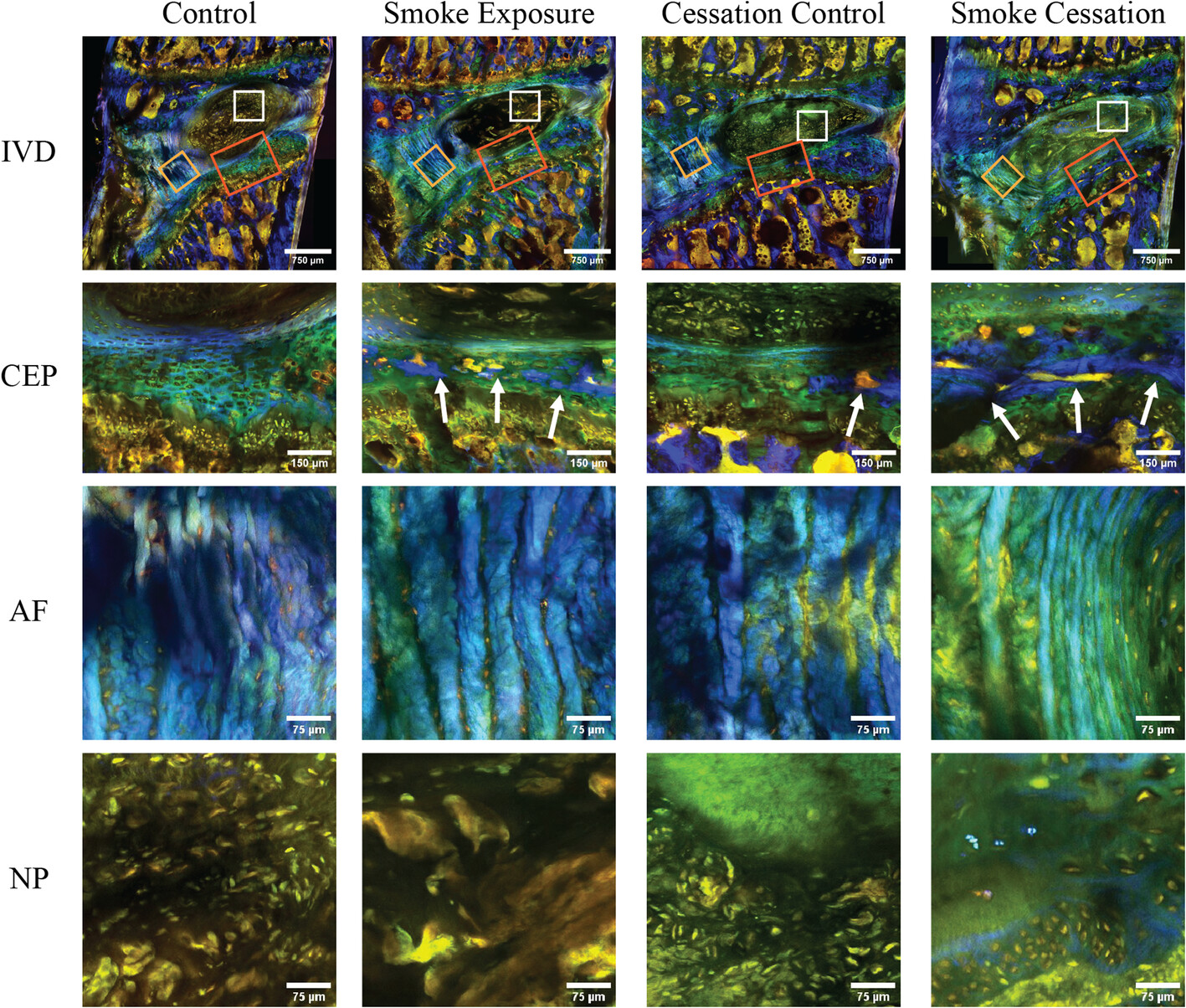 Effect of cigarette smoke exposure and cessation on regional diffusion properties in rat intervertebral discs