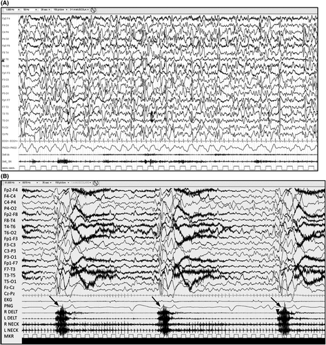 Details are in the caption following the image Details are in the caption following the image