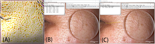 Details are in the caption following the image Details are in the caption following the image