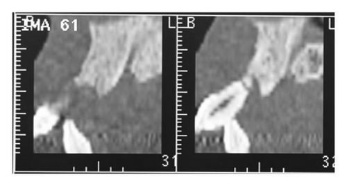 Details are in the caption following the image