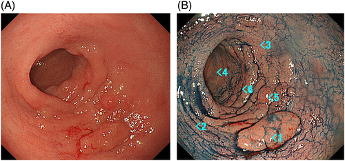 Details are in the caption following the image Details are in the caption following the image