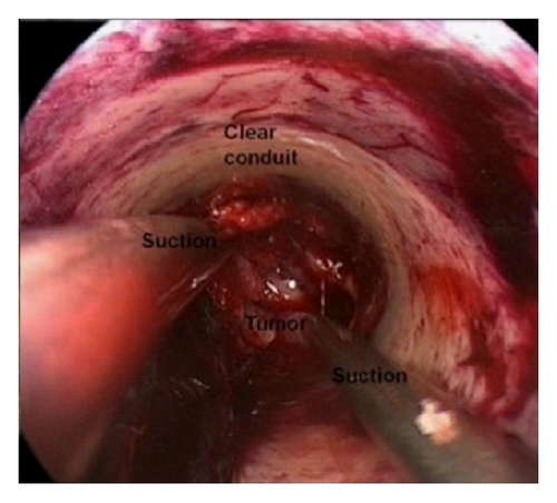 Details are in the caption following the image Details are in the caption following the image
