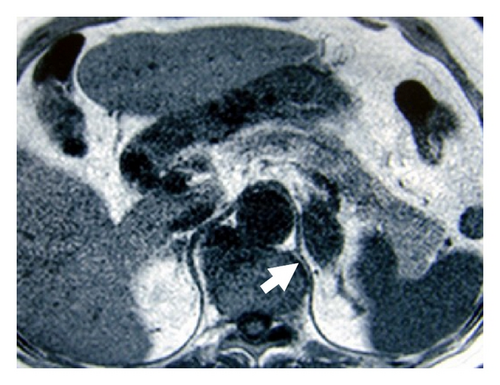 Details are in the caption following the image