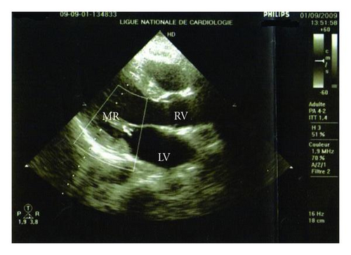 Details are in the caption following the image Details are in the caption following the image