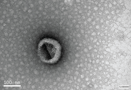 Details are in the caption following the image