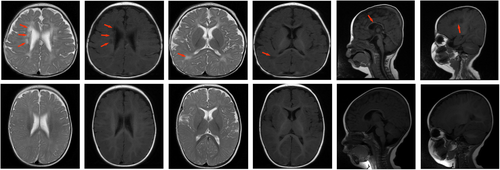 Details are in the caption following the image Details are in the caption following the image