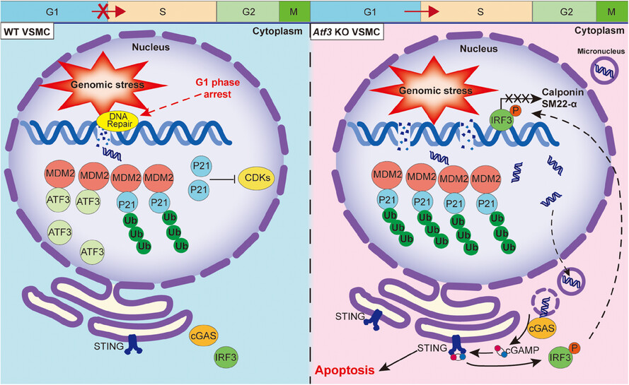 Deficiency of ATF3 facilitates both angiotensin II-induced and spontaneously formed aortic aneurysm and dissection development by activating cGAS–STING pathway