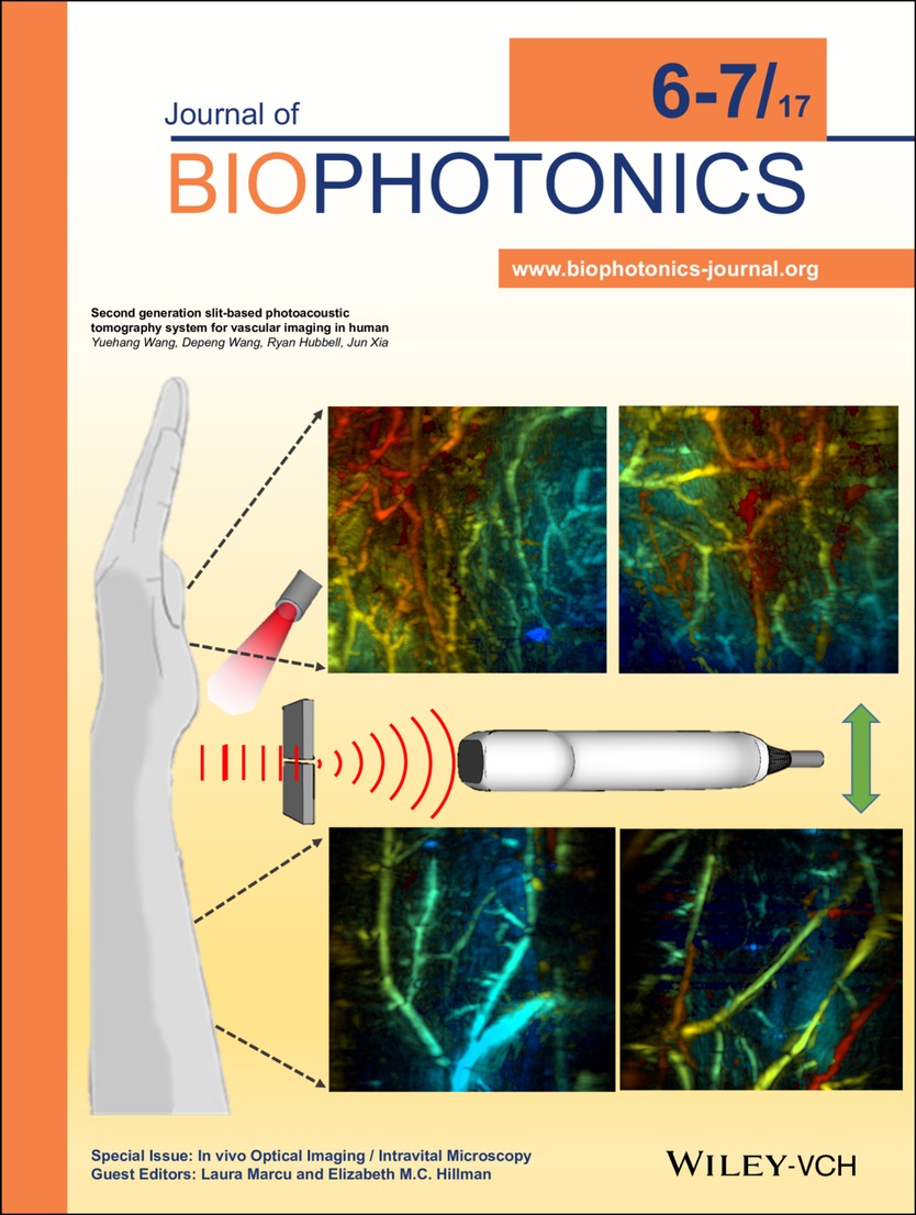 Back Cover: Second generation slit-based photoacoustic tomography system for vascular imaging in human (J. Biophotonics 6-7/2017) Volume 10 Issue 6-7, 2017