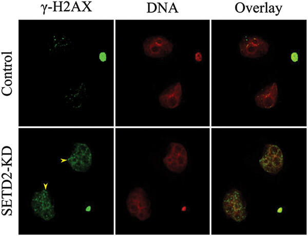 SETD2 reduction adversely affects the development of mouse early embryos