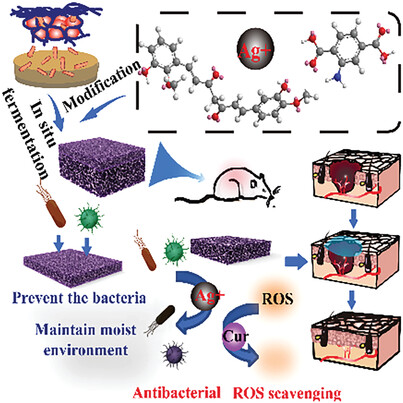 Multifunctional Asymmetric Bacterial Cellulose Membrane with Enhanced Anti-Bacterial and Anti-Inflammatory Activities for Promoting Infected Wound Healing