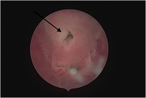 Details are in the caption following the image Details are in the caption following the image