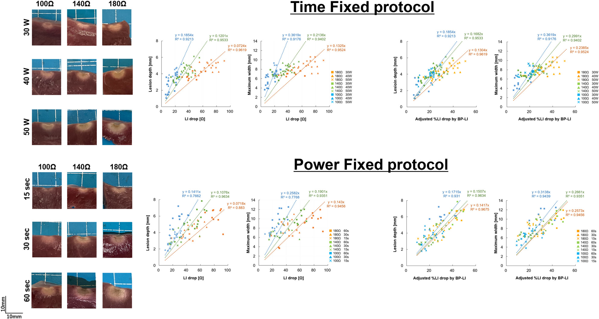 Impact of baseline-pool local impedance on lesion formation using a local impedance-sensing catheter: Lessons from a porcine experimental model