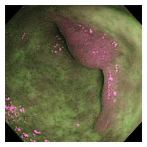 Details are in the caption following the image