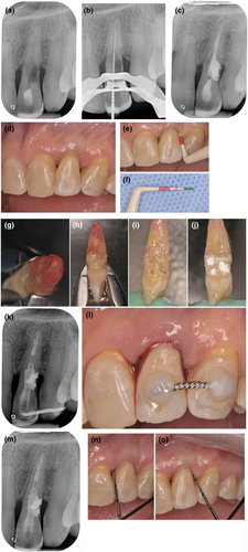 Details are in the caption following the image Details are in the caption following the image