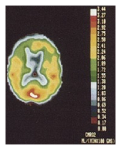 Details are in the caption following the image
