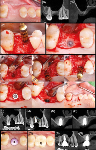 Details are in the caption following the image Details are in the caption following the image