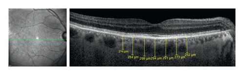Details are in the caption following the image