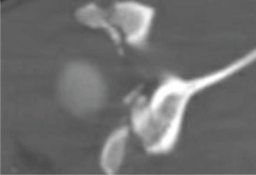 Details are in the caption following the image