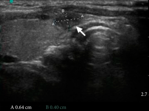 Details are in the caption following the image