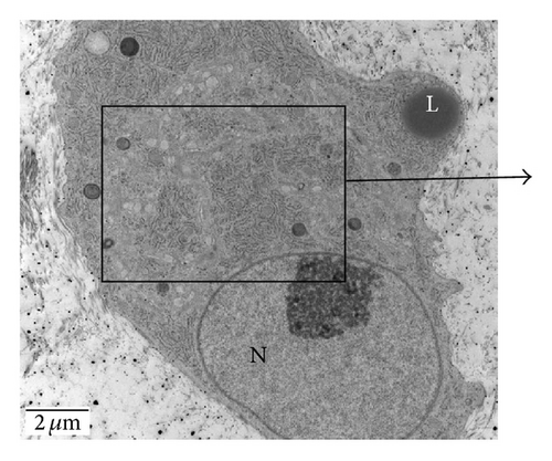 Details are in the caption following the image