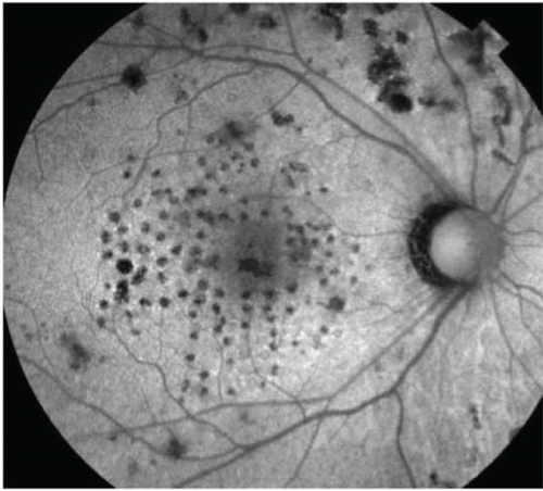 Details are in the caption following the image